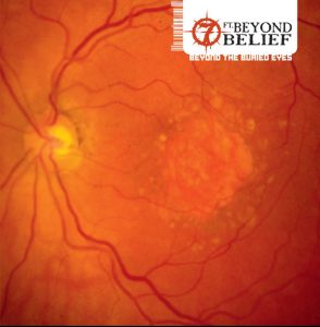 7ft Beyond Belief – Beyond The Buried Eyes