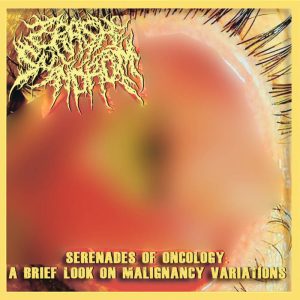Cannibe / Crash Syndrom – Muerte y miseria / Serenades of Oncology – A Brief Look on Malignancy Variations (Split)