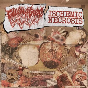 Ischemic Necrosis / Golem of Gore – Split