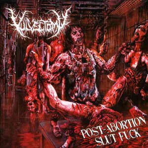 Vulvectomy – Post-Abortion Slut Fuck